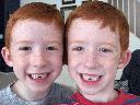 Twins Lost their teeth
